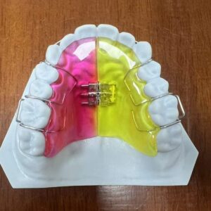 Removal Ortho