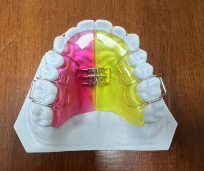 Removal Ortho