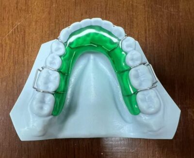Removal Ortho - Image 4