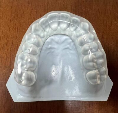 Removal Ortho - Image 3