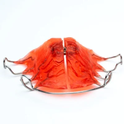 Anchor Palate - Image 2