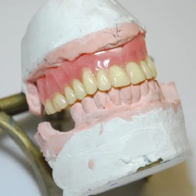 Heat Cure Dentures (1 Unit) - Image 2