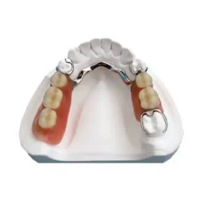 Metallic Denture (1 Jaw)
