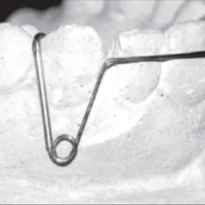 Retainer, Nance, Retractor's