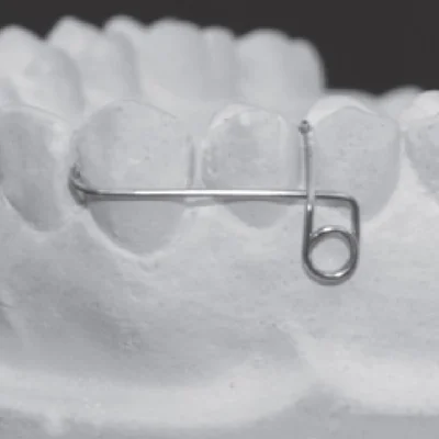 Retainer, Nance, Retractor's - Image 2