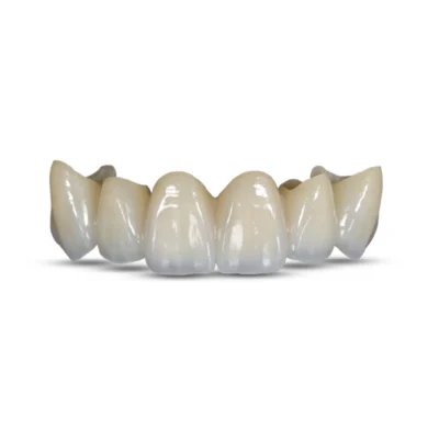 Zirconium Crown - Image 2
