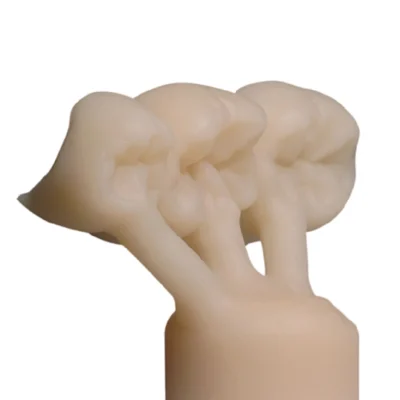 IPS e.max Press Crown - Image 2
