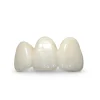 IPS e.max Press Crown